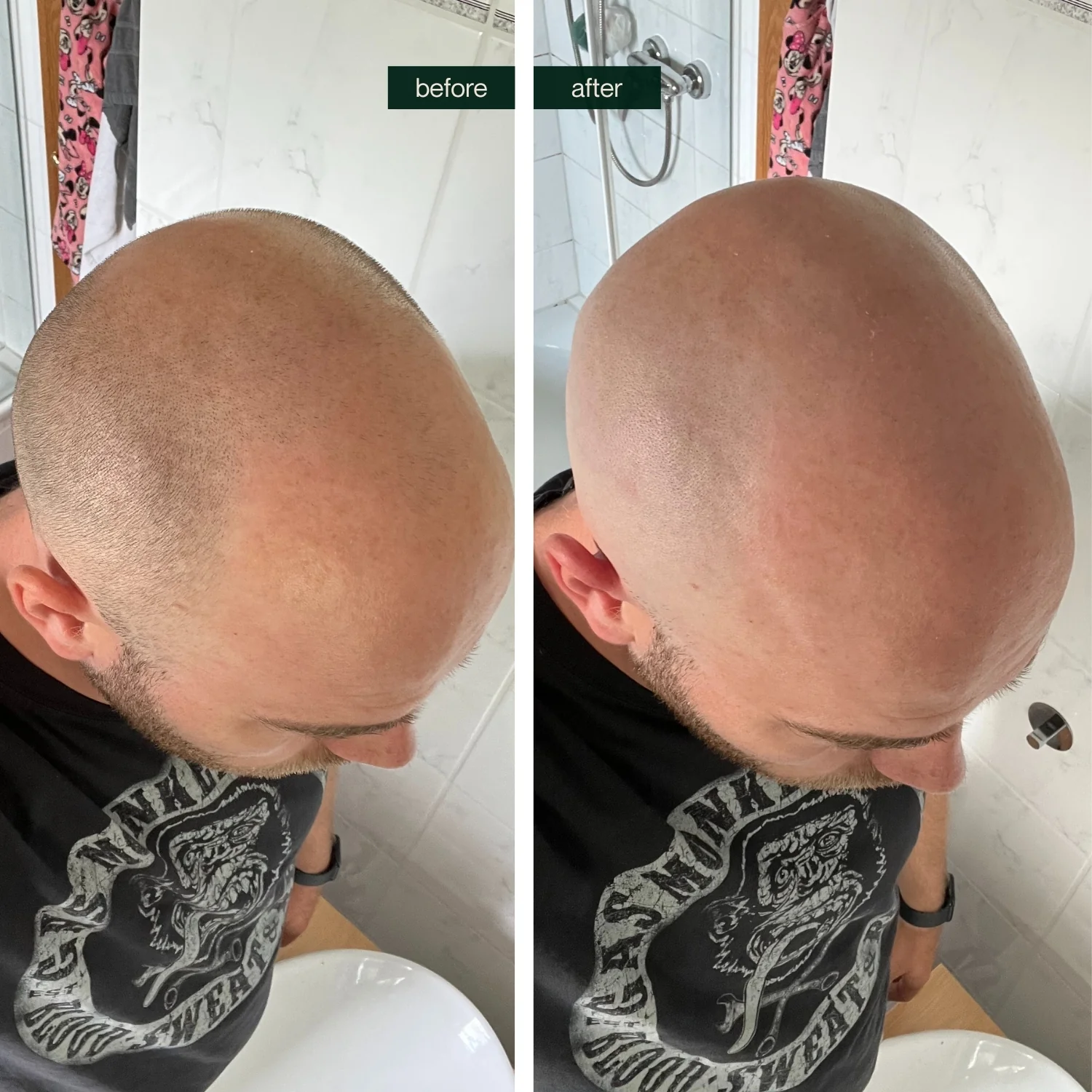 Ersatzklinge für den BOLD SHAVER mit Magnet-System - Image 8